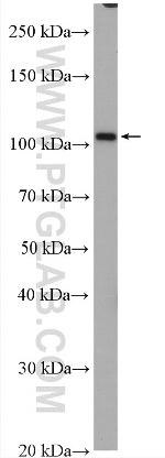 ZFPM1 Antibody in Western Blot (WB)
