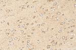CRB2 Antibody in Immunohistochemistry (Paraffin) (IHC (P))