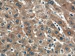 NKPD1 Antibody in Immunohistochemistry (Paraffin) (IHC (P))