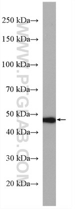 RAD52 Antibody in Western Blot (WB)