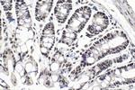 SON Antibody in Immunohistochemistry (Paraffin) (IHC (P))