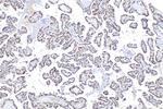 SON Antibody in Immunohistochemistry (Paraffin) (IHC (P))