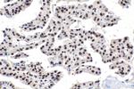 SON Antibody in Immunohistochemistry (Paraffin) (IHC (P))