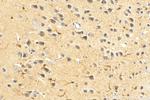 KPNA3 Antibody in Immunohistochemistry (Paraffin) (IHC (P))