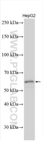 KPNA3 Antibody in Western Blot (WB)