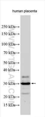 TMEM40 Antibody in Western Blot (WB)