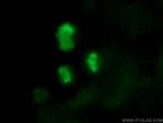 ki67 Antibody in Immunocytochemistry (ICC/IF)