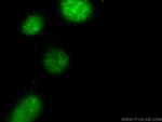 ki67 Antibody in Immunocytochemistry (ICC/IF)