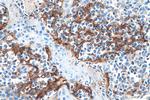 PD-L1/CD274 Antibody in Immunohistochemistry (Paraffin) (IHC (P))