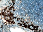 PD-L1/CD274 Antibody in Immunohistochemistry (Paraffin) (IHC (P))
