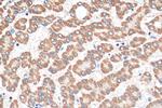 SEC22C Antibody in Immunohistochemistry (Paraffin) (IHC (P))