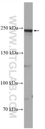 SCN1A Antibody in Western Blot (WB)