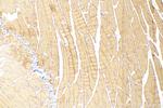 CYP26A1 Antibody in Immunohistochemistry (Paraffin) (IHC (P))