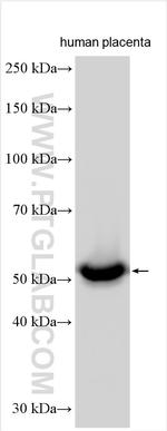 CYP26A1 Antibody in Western Blot (WB)