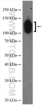 Cd31 Antibody in Western Blot (WB)