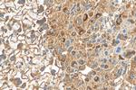 ALG3 Antibody in Immunohistochemistry (Paraffin) (IHC (P))