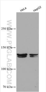 NPC1L1 Antibody in Western Blot (WB)