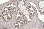 CUL3 Antibody in Immunohistochemistry (Paraffin) (IHC (P))