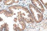 CUL3 Antibody in Immunohistochemistry (Paraffin) (IHC (P))