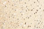CAMK2N2 Antibody in Immunohistochemistry (Paraffin) (IHC (P))