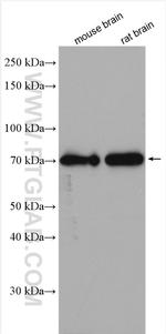 SLC38A5 Antibody in Western Blot (WB)