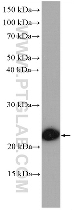 UQCC Antibody in Western Blot (WB)