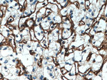 Endoglin/CD105 Antibody in Immunohistochemistry (Paraffin) (IHC (P))