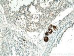 MUC5B Antibody in Immunohistochemistry (Paraffin) (IHC (P))