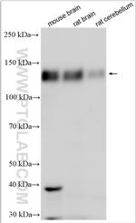 DLGAP1 Antibody in Western Blot (WB)
