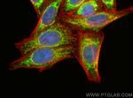 NDUFS2 Antibody in Immunocytochemistry (ICC/IF)