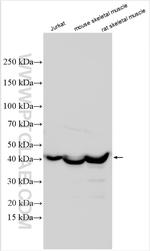 NDUFS2 Antibody in Western Blot (WB)