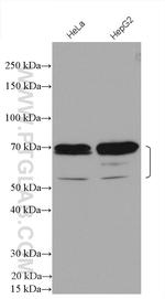 ZBTB7B Antibody in Western Blot (WB)