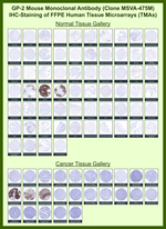 GP2 (Glycoprotein 2)/ZAP75 Monoclonal Antibody (MSVA-475M)