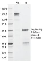 GP2 (Glycoprotein 2)/ZAP75 Antibody in SDS-PAGE (SDS-PAGE)