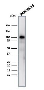 GP2 (Glycoprotein 2)/ZAP75 Antibody in Western Blot (WB)