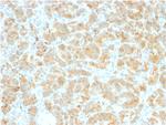 GP2 (Glycoprotein 2)/ZAP75 Recombinant Rabbit Monoclonal Antibody (GP2/2569R)