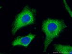 GSPT1 Antibody in Immunocytochemistry (ICC/IF)