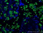 SLC4A1 Antibody in Immunohistochemistry (PFA fixed) (IHC (PFA))