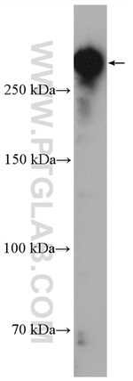 CENPE Antibody in Western Blot (WB)