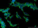 DPP6 Antibody in Immunocytochemistry (ICC/IF)
