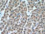 CCDC71 Antibody in Immunohistochemistry (Paraffin) (IHC (P))