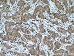 CCDC71 Antibody in Immunohistochemistry (Paraffin) (IHC (P))