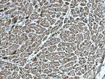 TENC1 Antibody in Immunohistochemistry (Paraffin) (IHC (P))