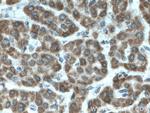 TENC1 Antibody in Immunohistochemistry (Paraffin) (IHC (P))