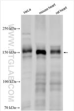 TENC1 Antibody in Western Blot (WB)