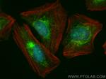 CDADC1 Antibody in Immunocytochemistry (ICC/IF)