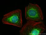 CDADC1 Antibody in Immunocytochemistry (ICC/IF)