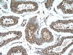 CDADC1 Antibody in Immunohistochemistry (Paraffin) (IHC (P))