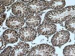 CDADC1 Antibody in Immunohistochemistry (Paraffin) (IHC (P))