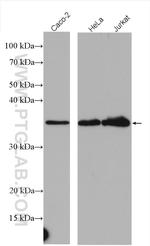 CDC123/C10orf7 Antibody in Western Blot (WB)